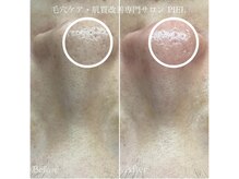 ピエル 北千住店(PIEL)/相乗効果