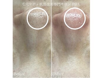 ピエル 北千住店(PIEL)/相乗効果