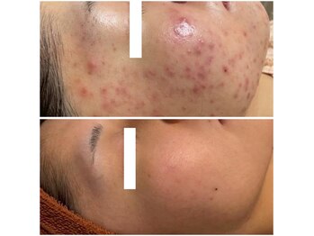 エレファンテブランコ(Elefante Blanco)