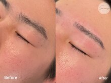 サラン(Sarang)/眉毛WAX脱毛before after