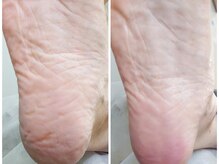 リゼラアンドコー 浦安店/ドイツ式フットケア専門店