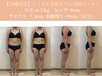 エターナルフレーム(Eternal Flame)/50歳痩身スリムビフォーアフター