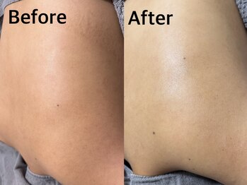 ベール(BEHL)/ジェリーマスクのBefore After