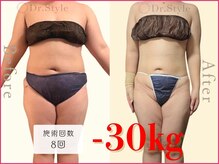 ココア整体 岐阜店(cocoa整体)/最新痩身マシン/脂肪燃焼リンパ