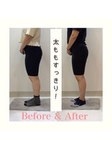 スタイルラボ高松/産後の骨盤矯正の効果♪