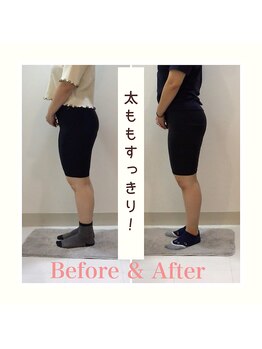 スタイルラボ高松/産後の骨盤矯正の効果♪