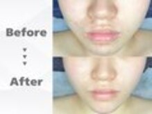 和歌山ララピール&韓国肌管理専門店