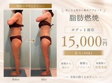 ザ ピーチ(THE PEACH)の雰囲気（ボディも脂肪燃焼！脂肪細胞を減少させてリバウンドも防げる！）