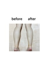 ステラ(stella)/ふくらはぎ痩せ