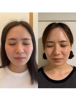 こうぞう整体院/美容鍼×筋膜リリース