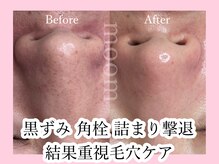 ムーム なんば店(moom)の雰囲気（結果が出る本気の毛穴洗浄！！ツルスベ肌を手に入れましょう◎）