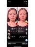 【平日11時～16時限定】小顔造形コルギ+石膏パック+お得オプション60分¥8800