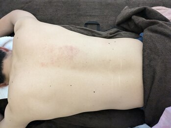 リデザイン 京都(REDESIGN)/