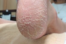 あいの巻き爪補正所