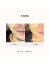 癒し処 ほっこり 海田店/【ビフォーアフター】