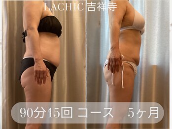 ラシク 吉祥寺(LACHIC)/ぽっこりお腹すっきり