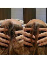 サロン ソワイユ(salon soyeux)/ヒアル酸不要の頭蓋骨小顔矯正♪