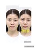 【ハリツヤUP】エンダモロジーフェイシャル60分￥16,000→￥9,800　女性専用