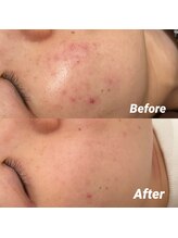 ロウエン(LAUEN)/