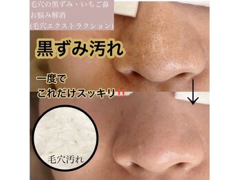 ロミエール(LOMIERE)/毛穴エクストラクション