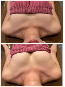 ロココ 錦糸町店(Rococo)/比較写真