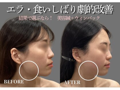 ミプラス鍼灸スタジオの写真