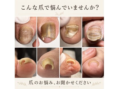 爪屋ソウジロウ(SOJIRO)の写真