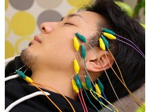 セットアップ鍼灸院(setup鍼灸院)の雰囲気（lift up美容鍼）