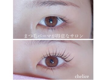 シェリス(Chelice)/