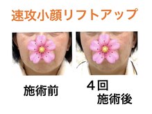 鍼灸サロンオランジュ 高槻富田院/