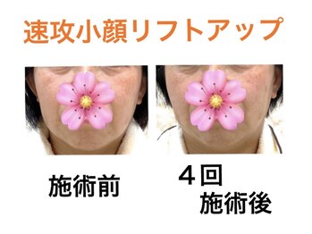 鍼灸サロンオランジュ 高槻富田院/