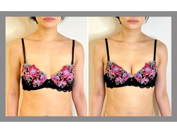 蒼(so)/小顔&強コリ&歪み改善、バストUP