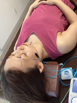 ハリファ鍼灸院 横浜関内院(HariFa鍼灸院)/美容施術/美容鍼