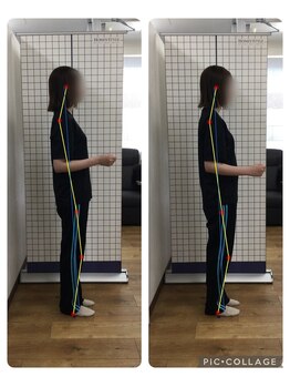 ボディメイク整体院 横浜駅西口店(BodyMake)/施術風景-姿勢を改善したい女性-