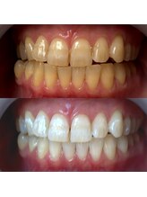 ワールドビューティー(World Beauty)/30代女性/ホワイトニング