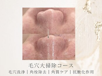 アネラボーテ(Anela Beaute)/毛穴の大掃除コース◎角栓洗浄