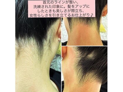 カロス(Calos)の写真
