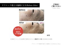 レミュ(Lemyu)の雰囲気(幹細胞の力で肌を根本改善♪是非、その効果を実感ください!)