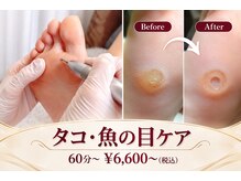 プラスキュア 用賀店(+CURE)の雰囲気（巻き爪・肥厚爪・魚の目など相談しづらい足のお悩みも丁寧にケア）
