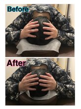 スカイ 鍼灸整骨院 整体院(SKY)/小顔矯正