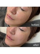 ニーナアイプラス(nina eye+)/マリムーブフェイシャルワックス