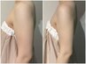 【ブライダルエステ】一撃で細くなりたい花嫁様向けカウンセリング　¥0