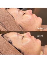 ルミナス(Luminous)/ララピール