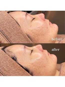 ルミナス(Luminous)/ララピール