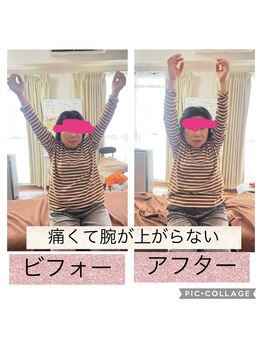 新リンパサロン 大阪/肩が上がる