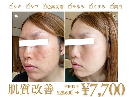 アンシャンテ 神戸元町店(Enchante)の写真