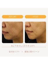 ムーンライズ(moonrise)/