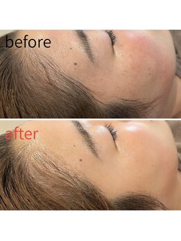 モアビューティー 紙屋町店/【ツヤ、爆誕】