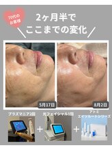 エネイブル(ENable)/