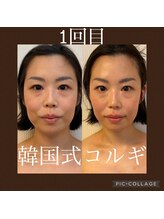 トータルビューティーサロン キララ(KIRARA)/韓国小顔コルギ　石膏パック付